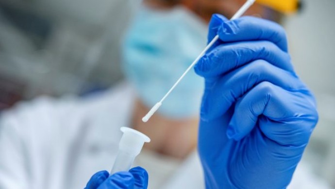 مراكز فحص كورونا في انطاليا